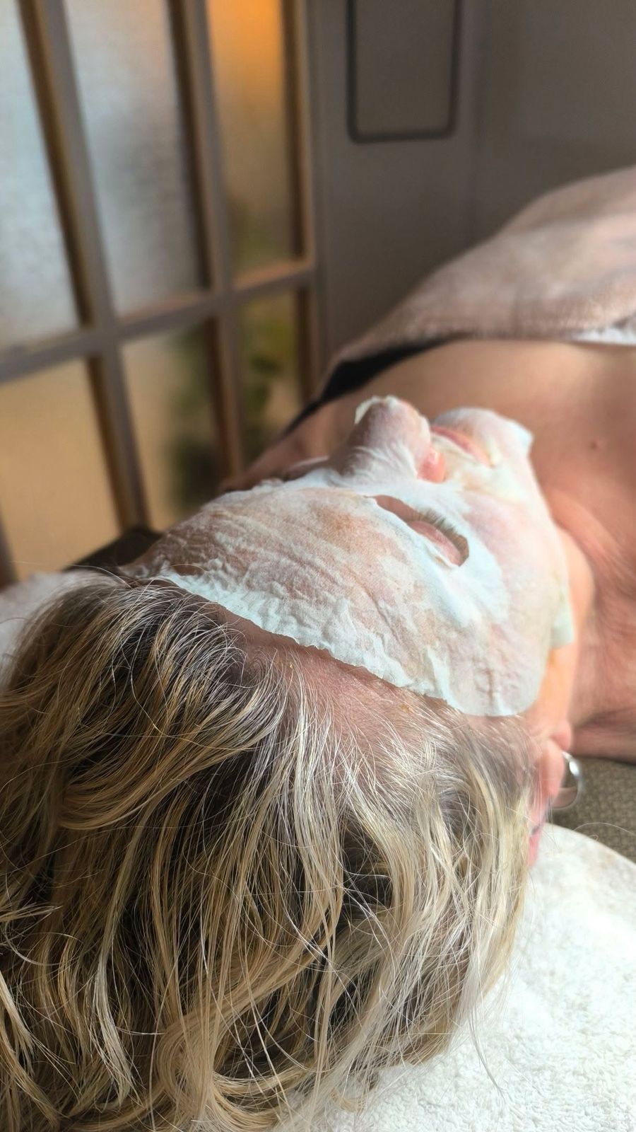 Dermapen y Tratamientos